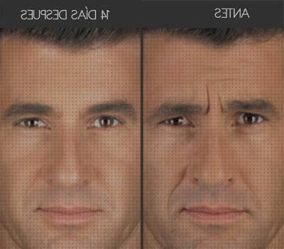 ¿Dónde poder comprar hombres botox hombres?