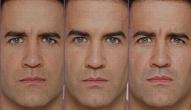 Review de botox hombres