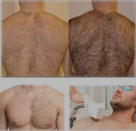 ¿Dónde poder comprar depiladora ipl hombre?