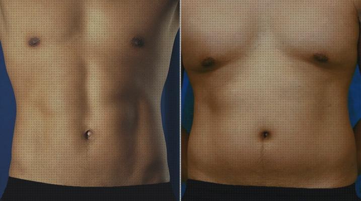 Las mejores marcas de hombres lipolaser hombres