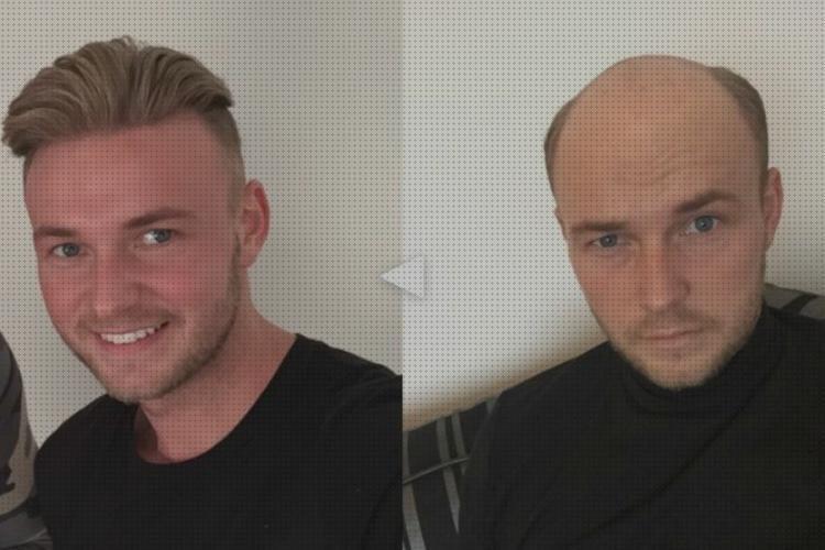Opiniones de los 18 mejores Peluquin De Hombres Pegados